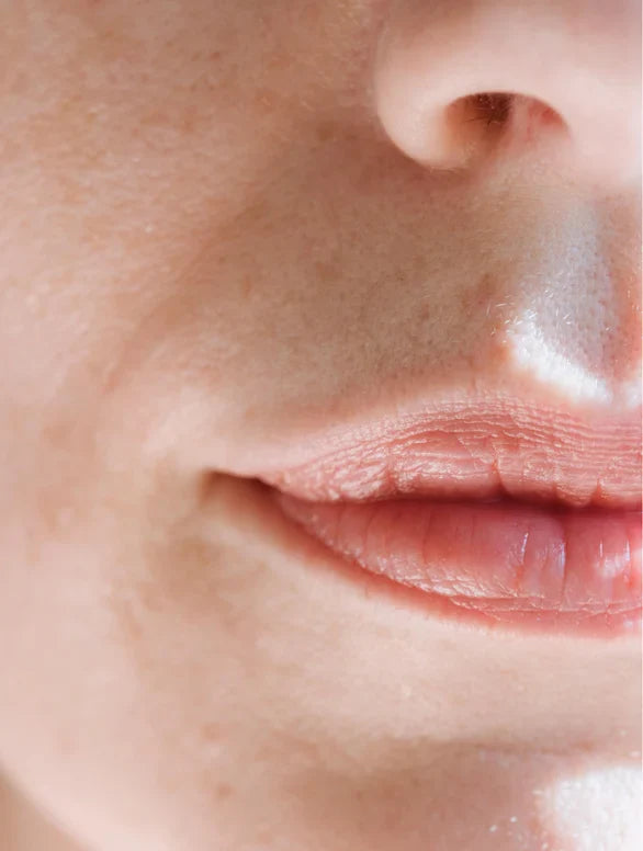 Sensitive Skin